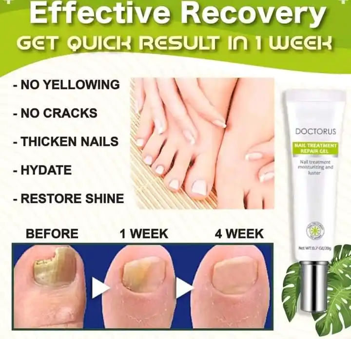 Efero Nail Treatment Repair Gel(20ml)