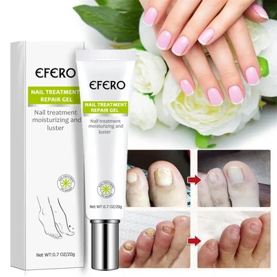 Efero Nail Treatment Repair Gel(20ml)
