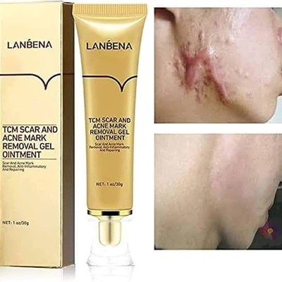 শরীরের যে কোন দাগ দূর করার ক্রিম